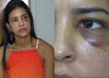 Secretária denuncia ter sido agredida por ex-namorado no Piauí — Foto: Reprodução / TV Clube