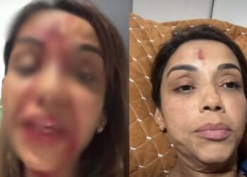 Cantora Walkiria Estarley surge ensanguentada e denuncia agressão do ex em Teresina 6 edicao imagens g1 31 .jpg