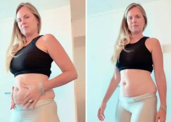 Susana Werner aposta em novo medicamento para perder peso e relata desafio 1 susana werner